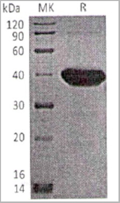 product-image-AAA22243_SDS_PAGE.jpg