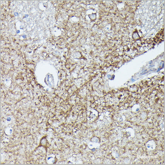 product-image-AAA22272_IHC3.jpg