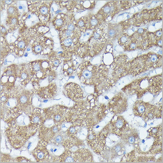 product-image-AAA22272_IHC4.jpg