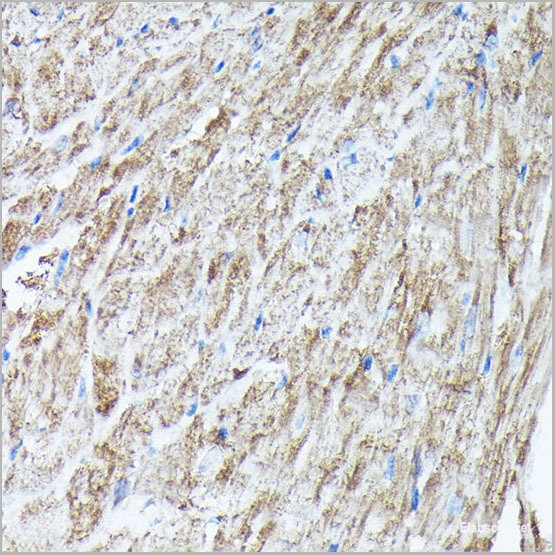 product-image-AAA22272_IHC5.jpg