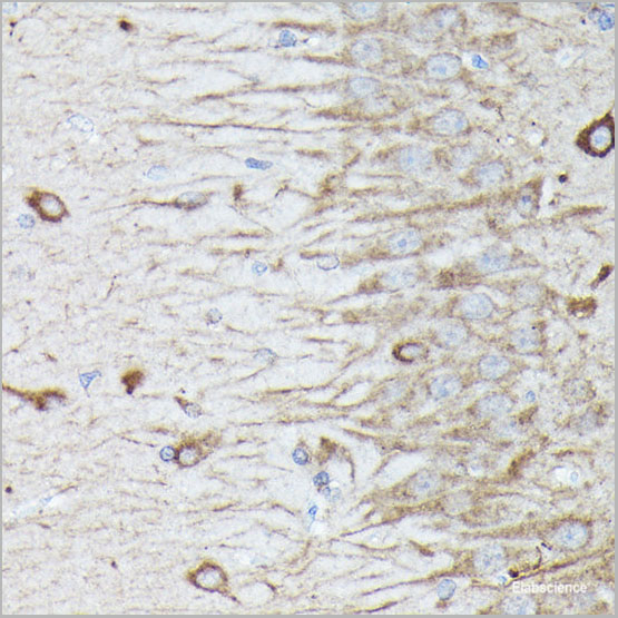 product-image-AAA22272_IHC6.jpg