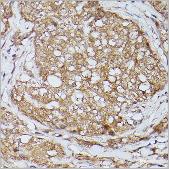product-image-AAA22273_IHC2.jpg