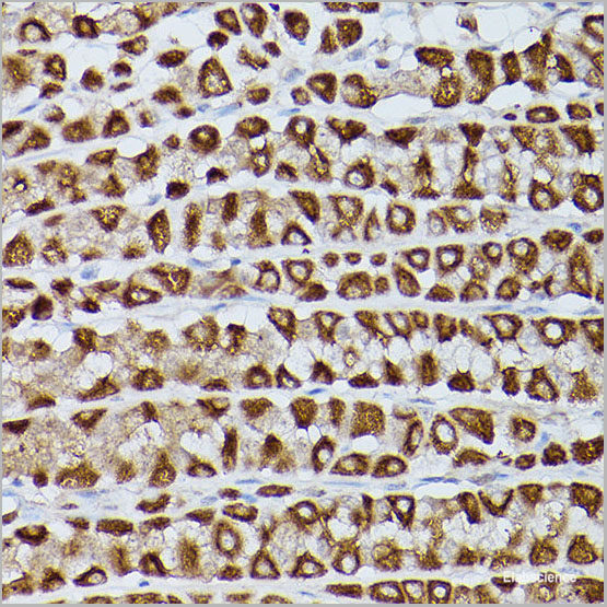product-image-AAA22273_IHC6.jpg