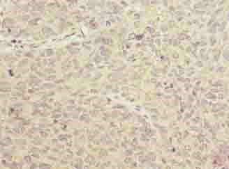 product-image-AAA230312_IHC13.jpg