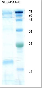 product-image-AAA23381_SDS_PAGE.jpg