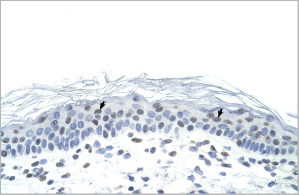 product-image-AAA23383_IHC.jpg