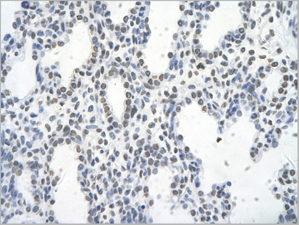 product-image-AAA23383_IHC3.jpg