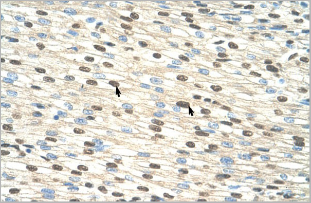 product-image-AAA23385_IHC.jpg