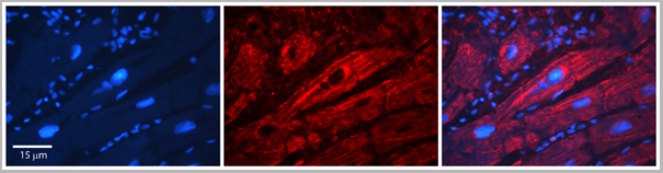 product-image-AAA23387_IHC.jpg
