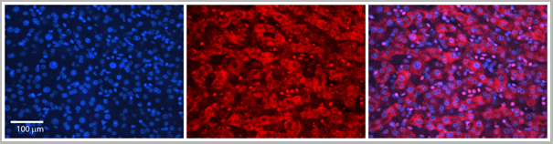 product-image-AAA23387_IHC2.jpg