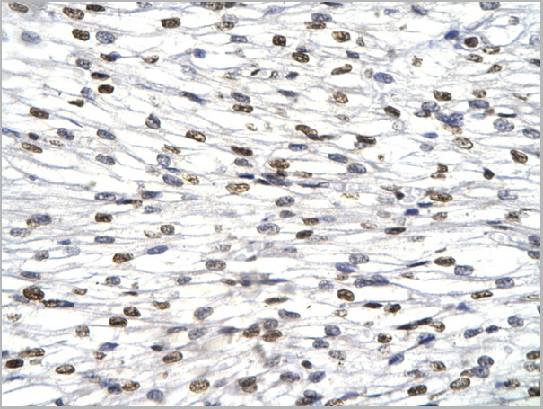 product-image-AAA23407_IHC2.jpg