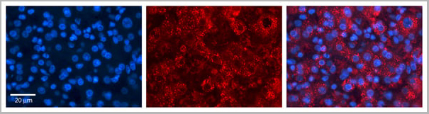 product-image-AAA23417_IHC.jpg