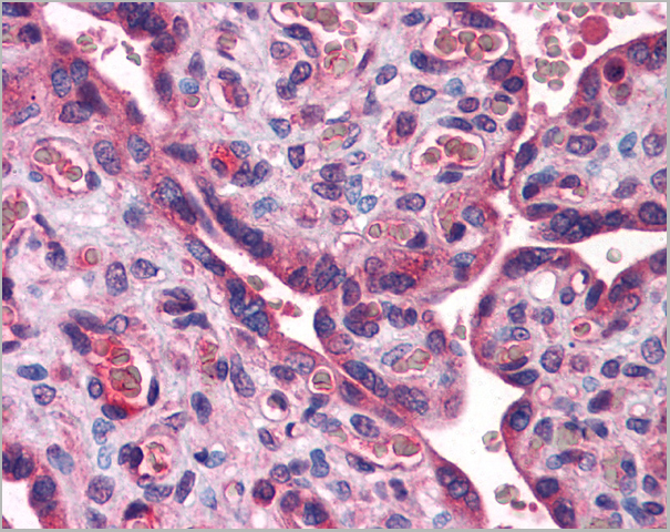 product-image-AAA23417_IHC2.jpg