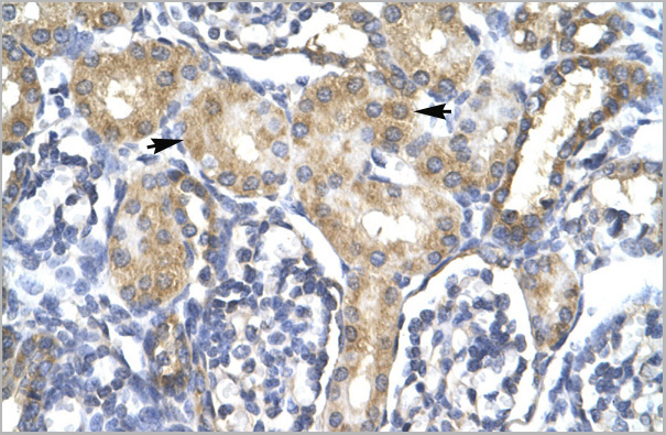 product-image-AAA23417_IHC3.jpg