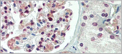 product-image-AAA23421_IHC2.jpg