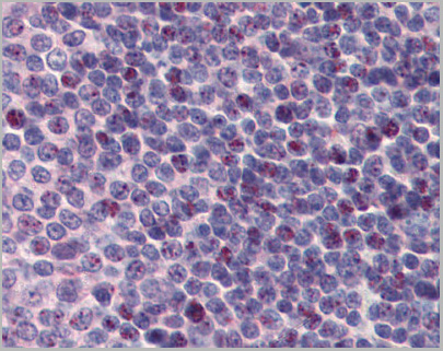 product-image-AAA23480_IHC.jpg