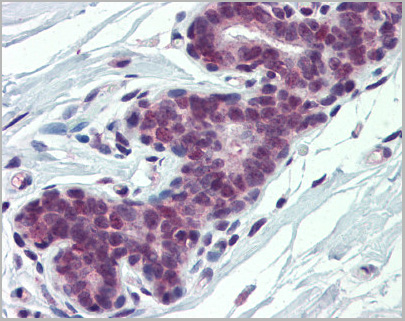 product-image-AAA23480_IHC2.jpg
