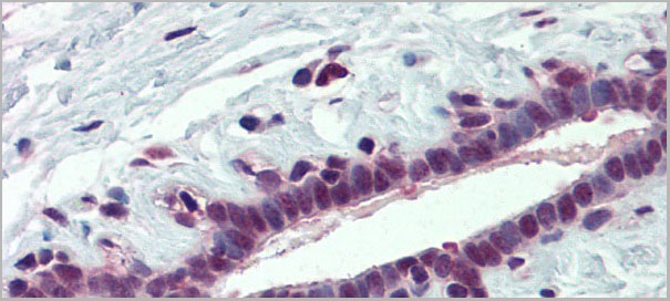 product-image-AAA23480_IHC3.jpg