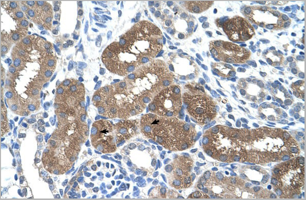 product-image-AAA23501_IHC.jpg