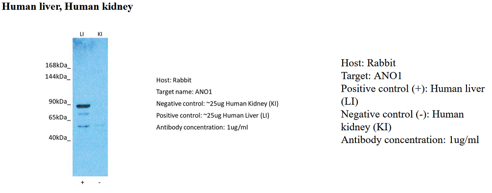 product-image-AAA23502_WB2.png