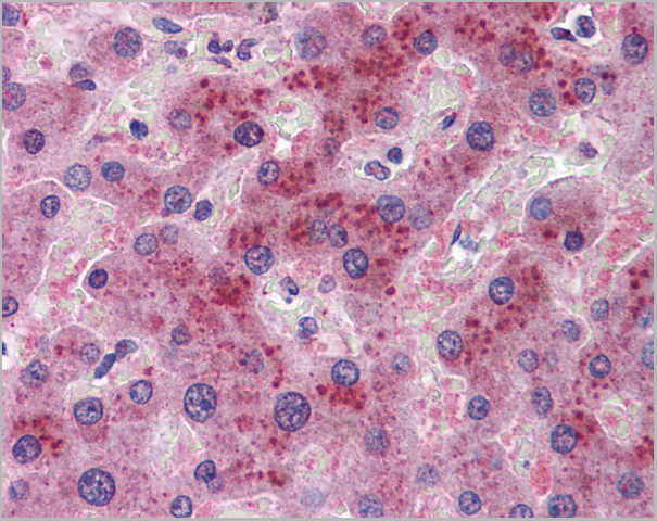 product-image-AAA23563_IHC.jpg