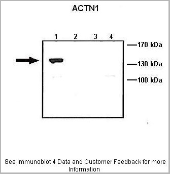 product-image-AAA23579_WB5.jpg