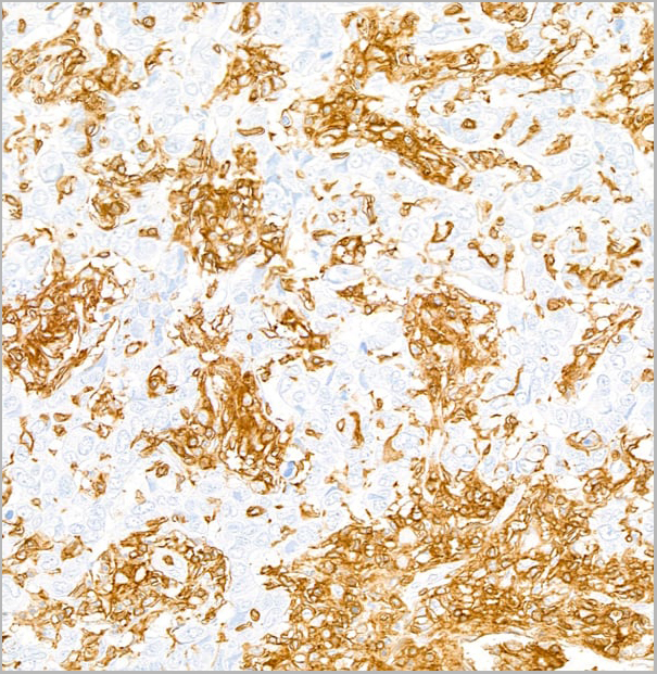 product-image-AAA23790_IHC4.jpg