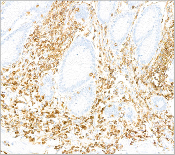 product-image-AAA23790_IHC5.jpg