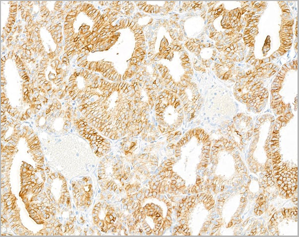 product-image-AAA23800_IHC4.jpg