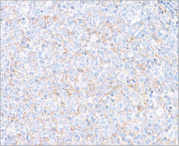 product-image-AAA23803_IHC3.jpg