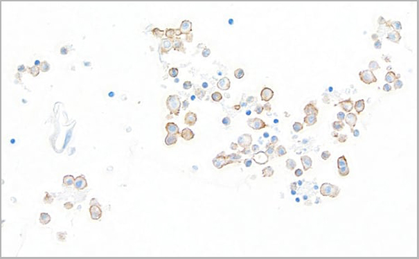 product-image-AAA23803_IHC4.jpg