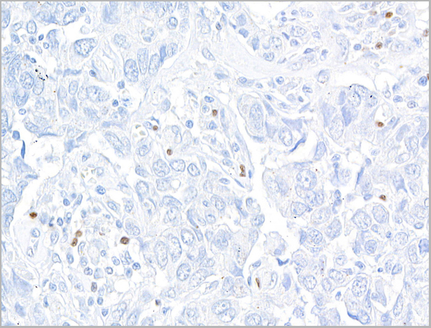 product-image-AAA23804_IHC2.jpg