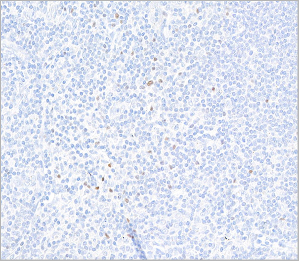 product-image-AAA23804_IHC3.jpg