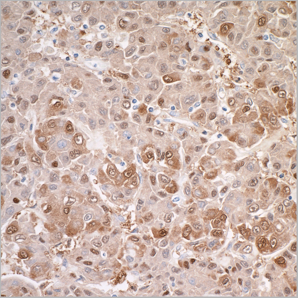 product-image-AAA23806_IHC2.jpg