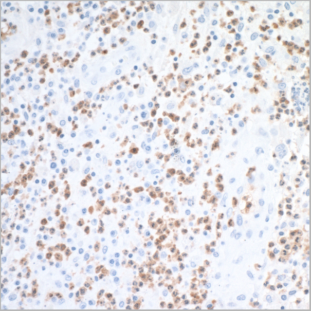 product-image-AAA23806_IHC3.jpg