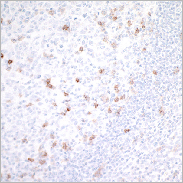 product-image-AAA23817_IHC3.jpg