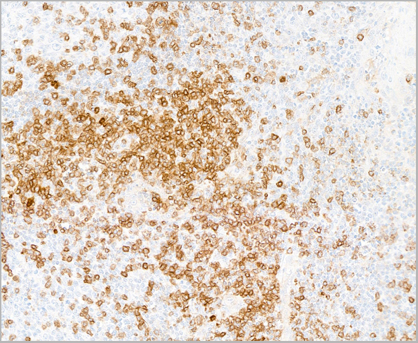 product-image-AAA23871_IHC5.jpg