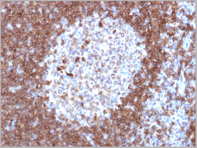 product-image-AAA23891_IHC.jpg