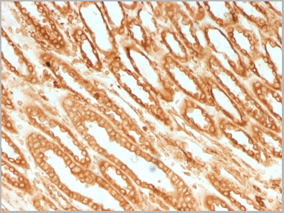 product-image-AAA23894_IHC.jpg