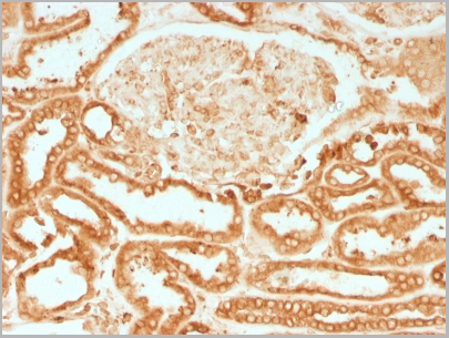 product-image-AAA23894_IHC2.jpg