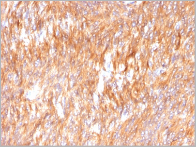 product-image-AAA23894_IHC3.jpg