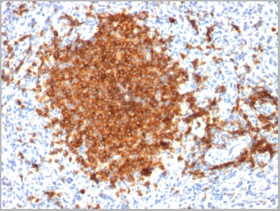 product-image-AAA23895_IHC.jpg