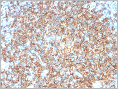 product-image-AAA23895_IHC2.jpg
