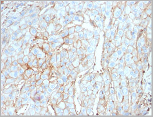 product-image-AAA23904_IHC.jpg