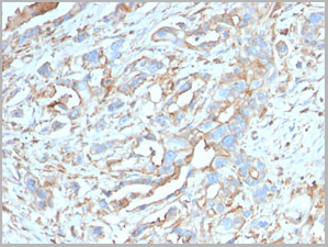 product-image-AAA23904_IHC2.jpg