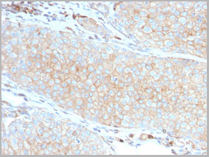 product-image-AAA23904_IHC3.jpg