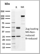 product-image-AAA23904_SDS_PAGE4.jpg