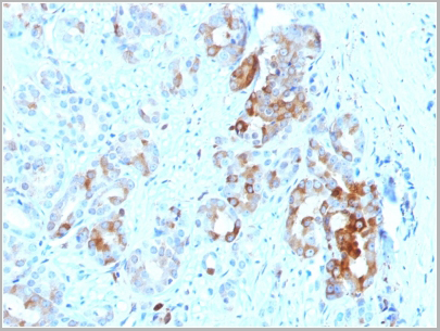 product-image-AAA23907_IHC2.jpg