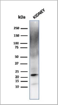 product-image-AAA23907_WB6.jpg