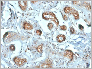 product-image-AAA23908_IHC.jpg